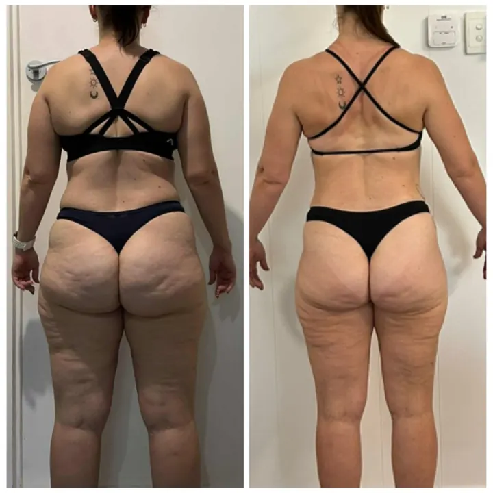 Rachel's own before-and-after progress photos, back view